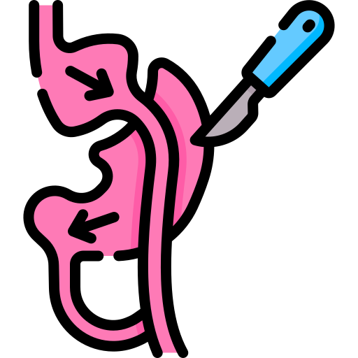 bypass-gastrico