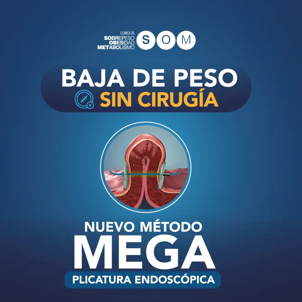 Baja de peso sin cirugia - metodo mega
