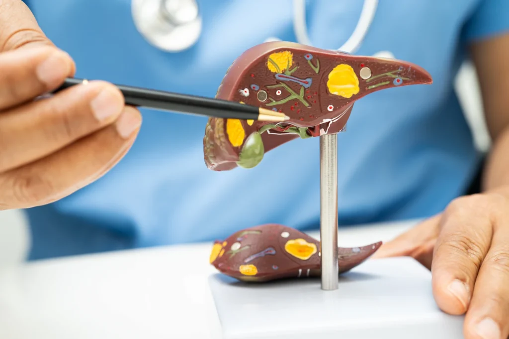 hígado graso antes y después del tratamiento - clinica de sobrepeso obesidad y metabolismo