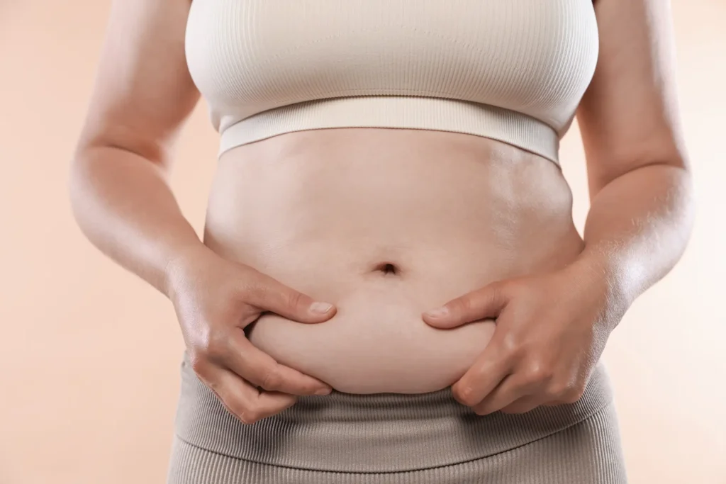 Clínica SOM | Mounjaro,mounjaro para bajar de peso,inyecciones para bajar de peso,bajar de peso,baja de peso Ilustración médica sobre cómo se acumula la grasa abdominal - clinica de sobrepeso obesidad y metabolismo