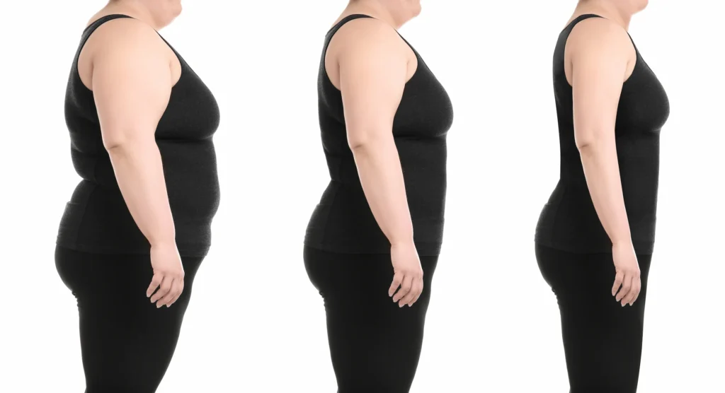 Clínica SOM | como funciona la manga gastrica,manga gastrica,manga gastrica precio,manga gastrica endoscopica,manga gastrica Quito Persona realizando ejercicio para bajar la grasa visceral - clinica de sobrepeso obesidad y metabolismo